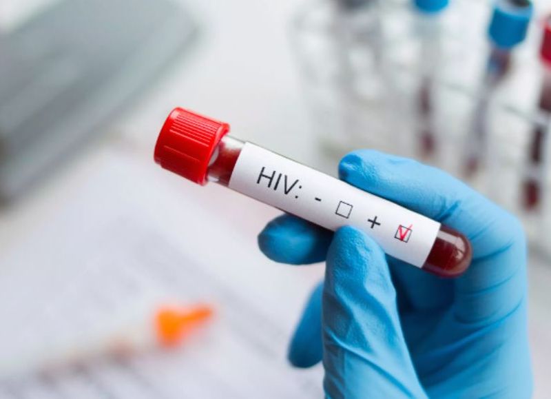 Homosexuales, trabajadores sexuales y haitianos concentran el 42% de casos de VIH, según COIN